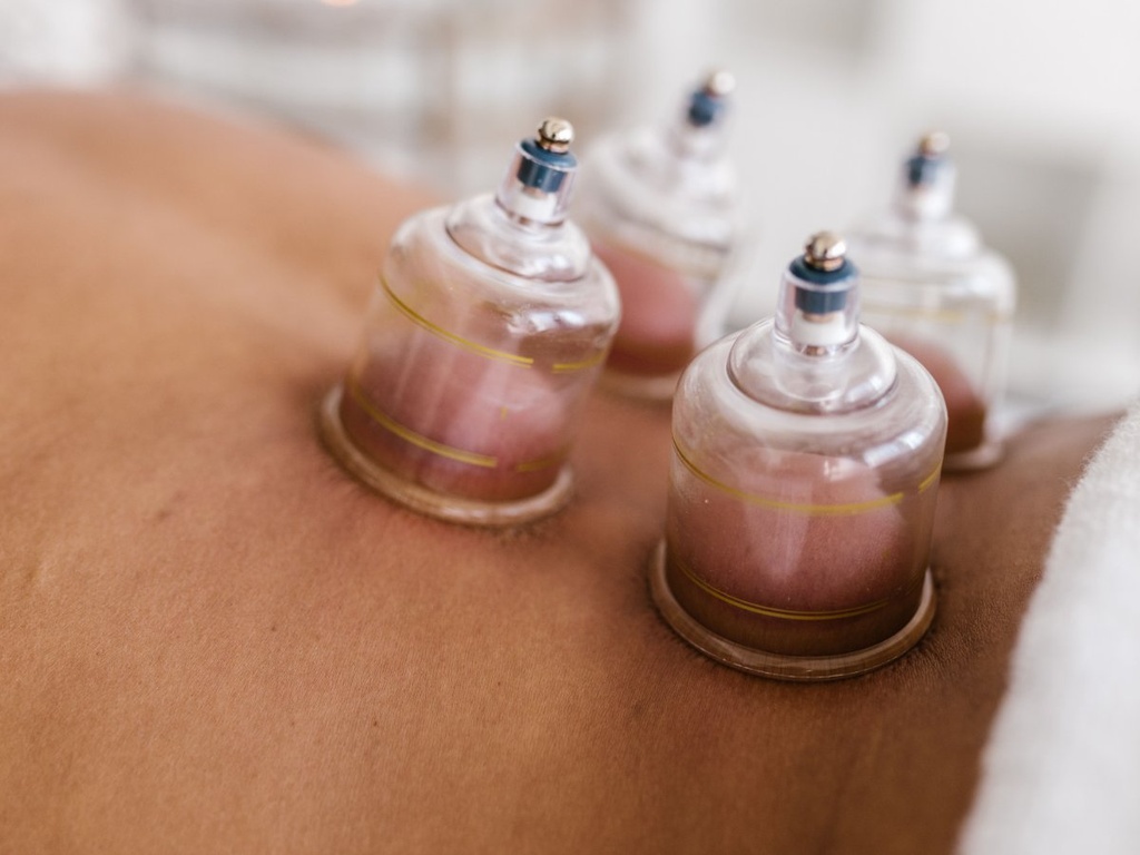 Cupping Therapy (60 min)